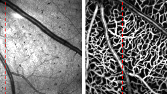 Visible-light OCT images of a mouse eye
